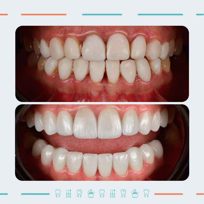 Orthopedist, Smile Designer: Nikoloz Khetsuriani