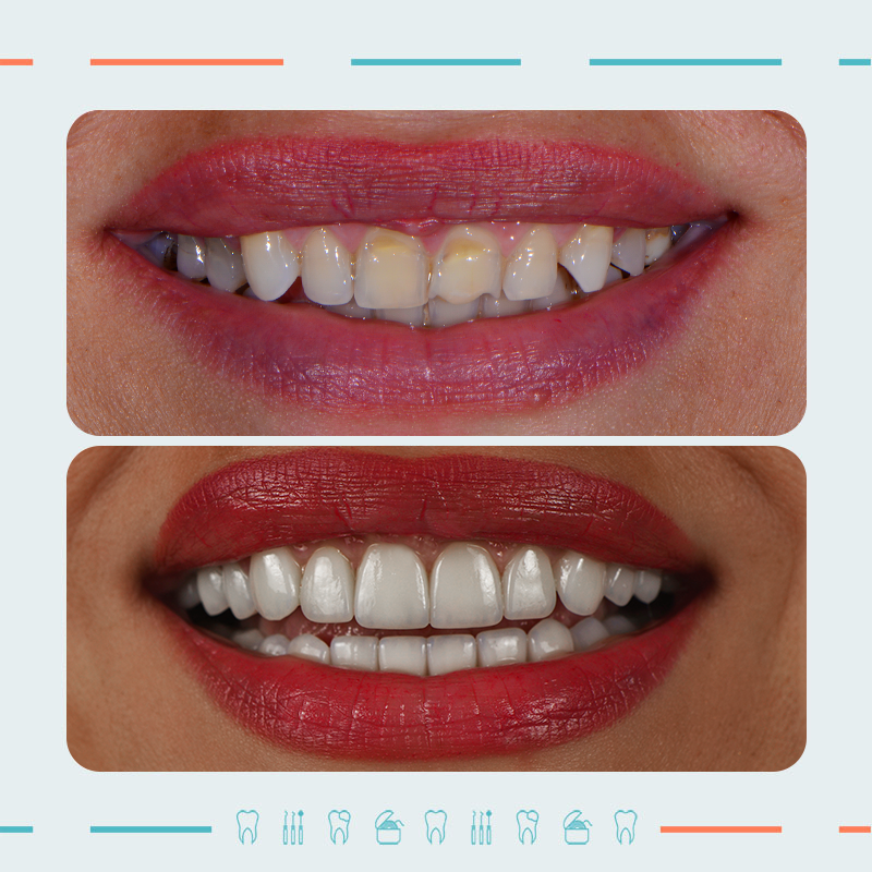 ორთოპედი, ღიმილის დიზაინერი: კახაბერ ხარებავა