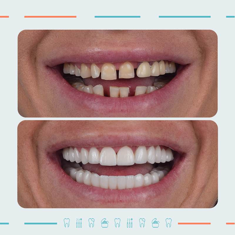 ორთოპედი, ღიმილის დიზაინერი: მიხეილ სიდამონიძე