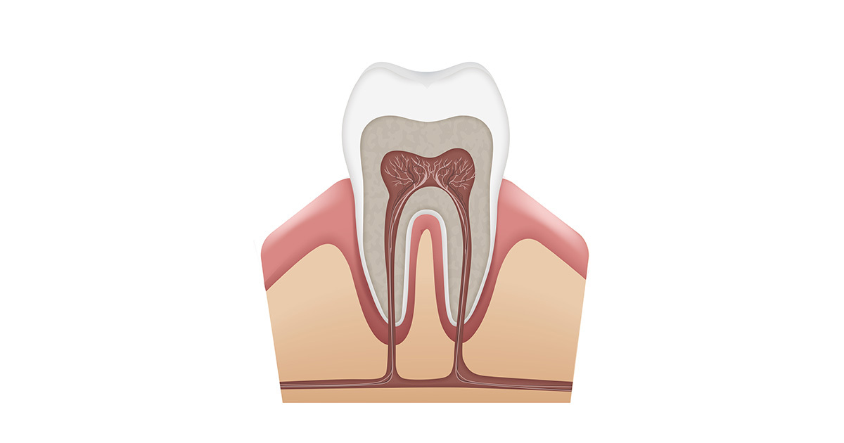 How Are Root Canals Treated?