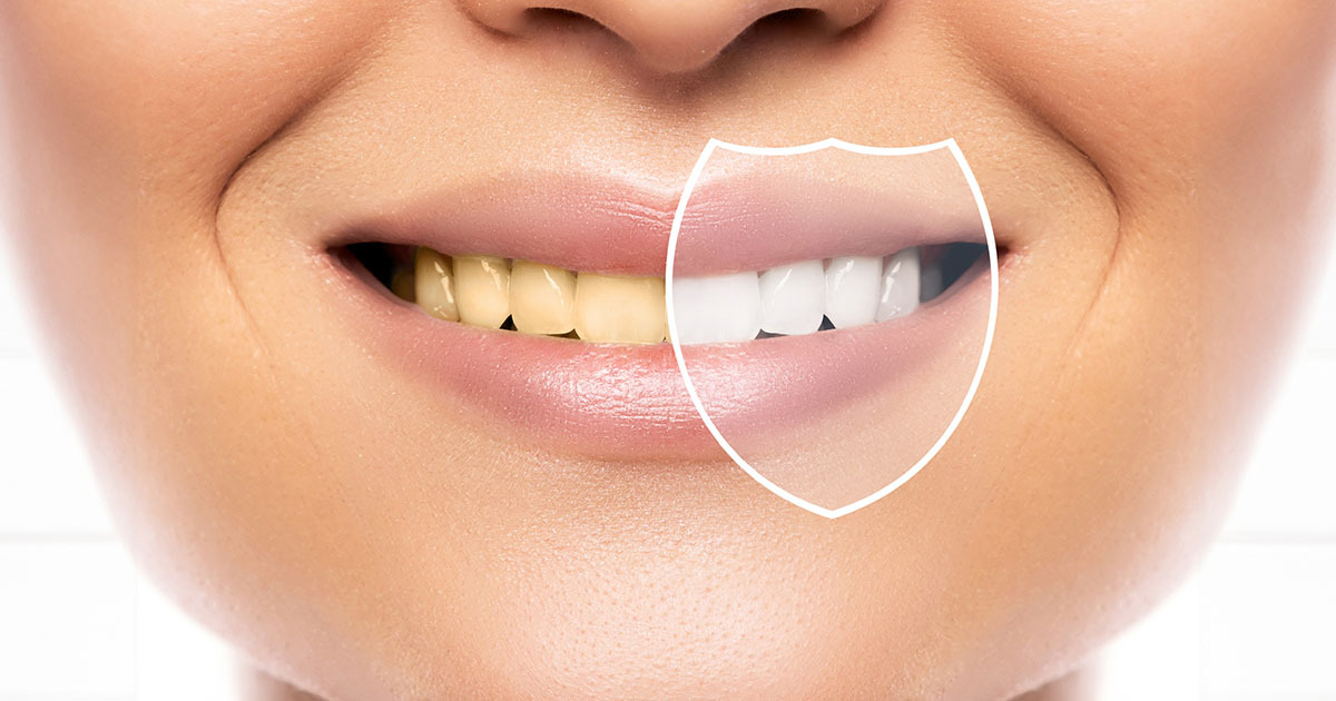 Oral Hygiene For Smokers