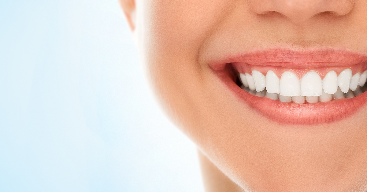 Teeth Wear And Veneers