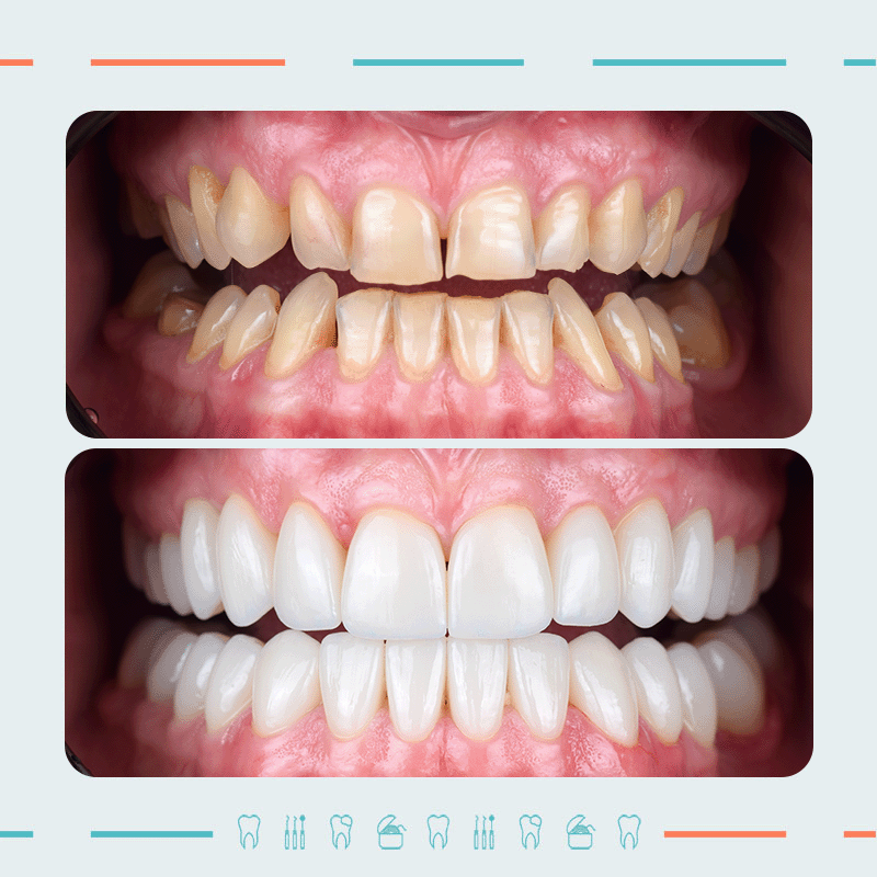 ორთოპედი, ღიმილის დიზაინერი: მიხეილ სიდამონიძე