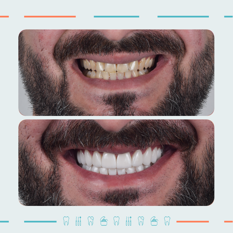 Prosthodontist: Mikheil Sidamonidze