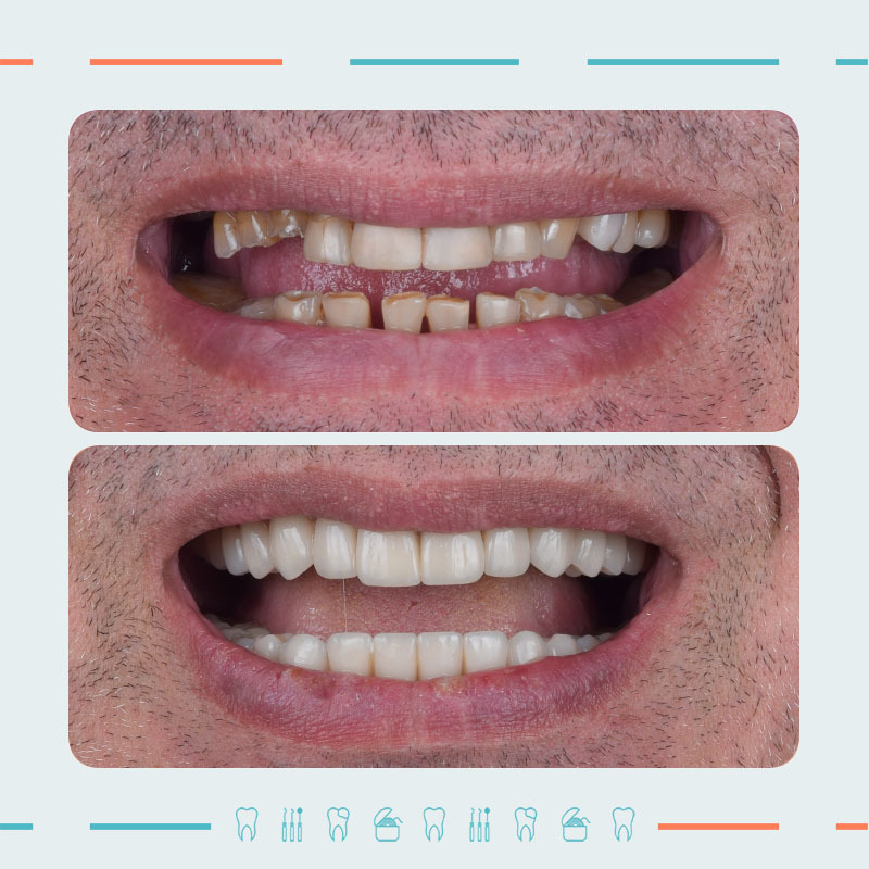 Prosthodontist: Mikheil Sidamonidze