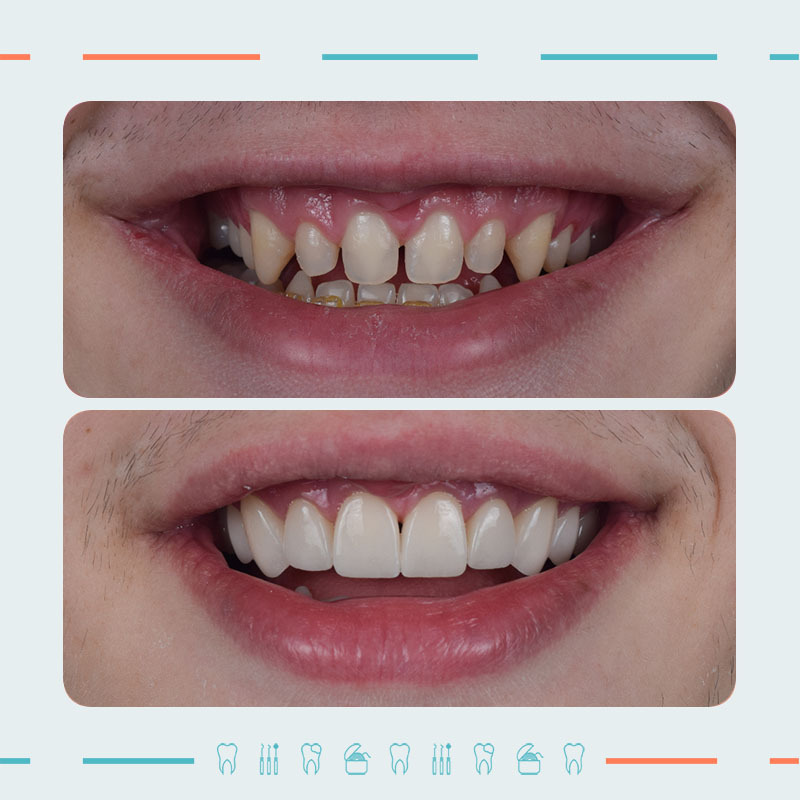 Prosthodontist: Mikheil Sidamonidze