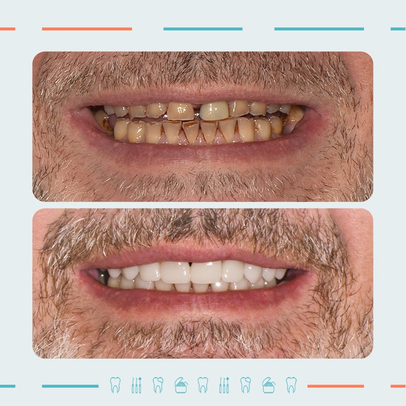 Prosthodontist, Smile designer: Nikoloz Khetsuriani