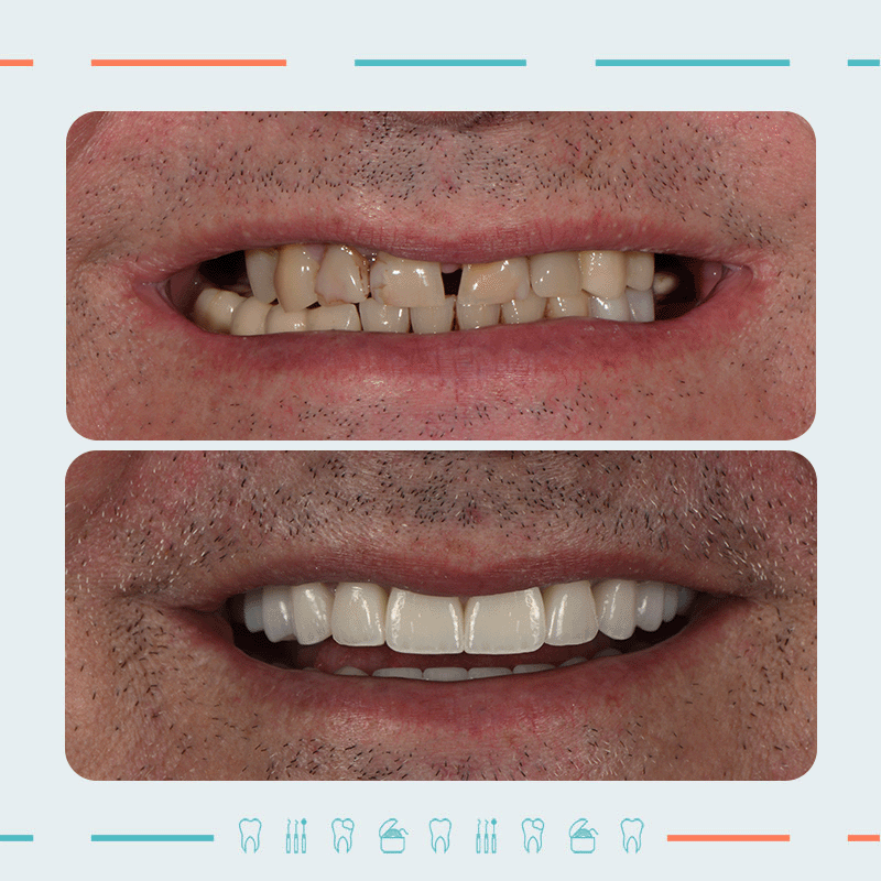 ორთოპედი, ღიმილის დიზაინერი: კახაბერ ხარებავა