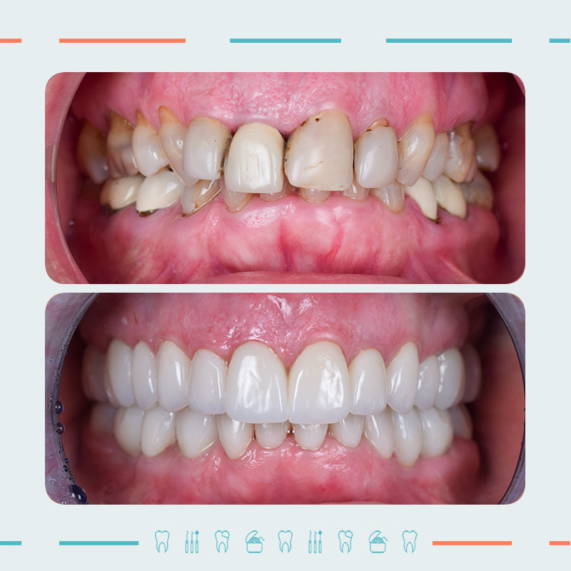 Prosthodontist: Mikheil Sidamonidze