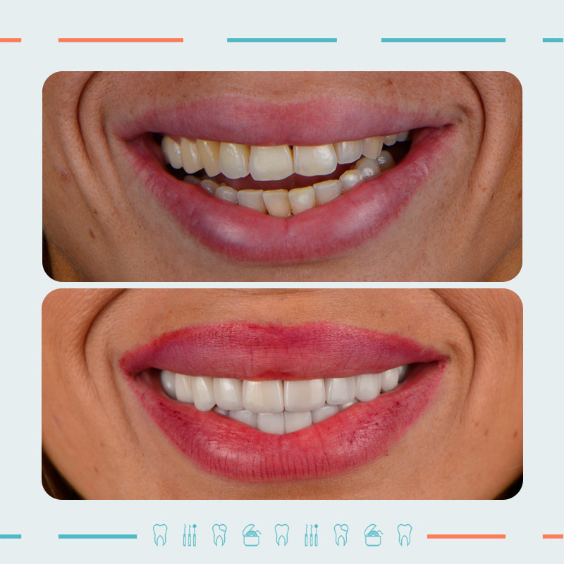 Orthopedist, Smile Designer: Nikoloz Khetsuriani