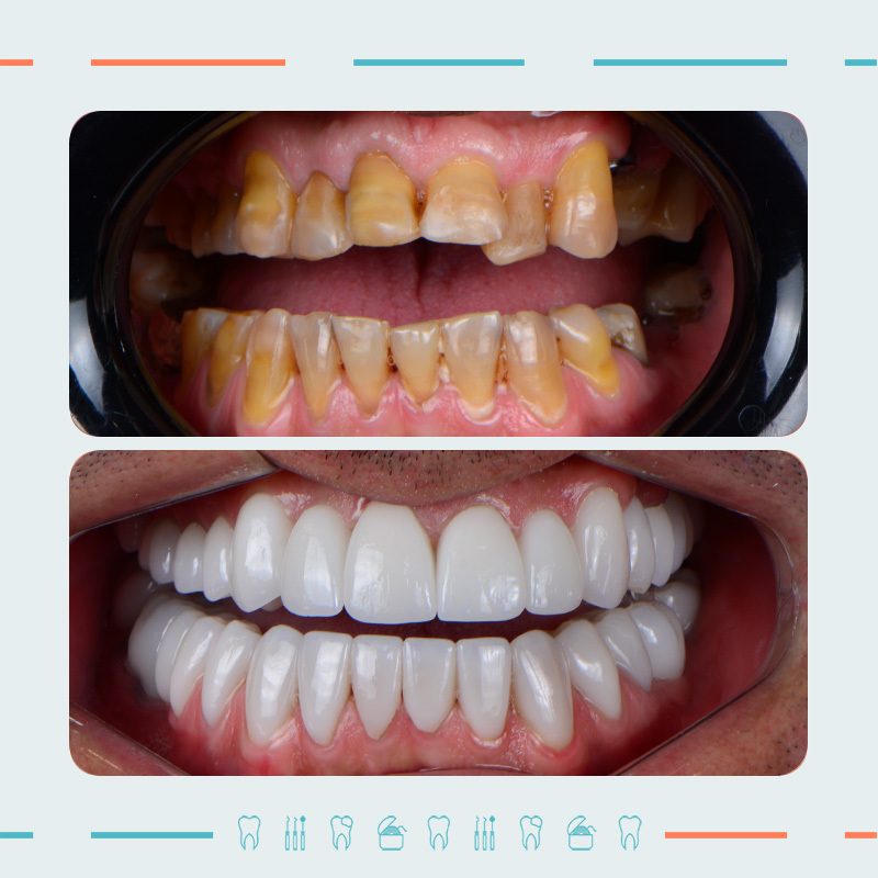 Prosthodontist: Nikoloz Khetsuriani