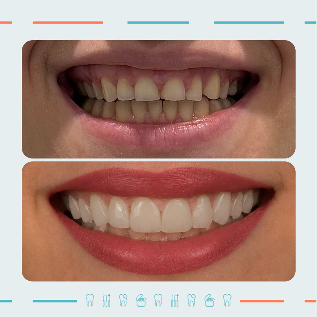 Prosthodontist & Smile Designer – Ramaz Tskhvaradze