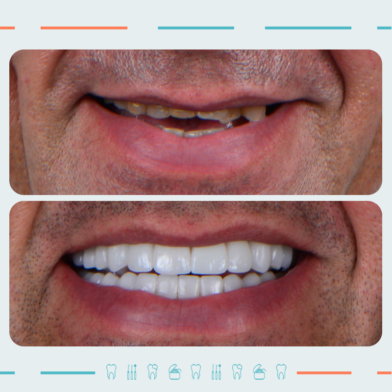 Prosthodontist: Nikoloz Khetsuriani